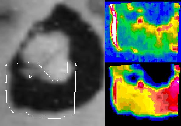 High temperatures observed by the NASA Galileo spacecraft along the western edge of the Loki volcano on Jupiter's moon Io may indicate freshly exposed material at the shore of a lava lake.